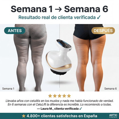 Celu Lift | Arti Control | Disuelve tu Celulitis Antes de Verano